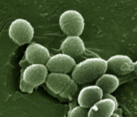 Enterococcus_faecalis_SEM_01_Detail